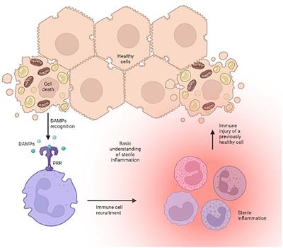 Sterile inflammation in liver transplantation